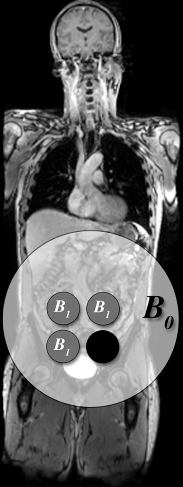 Figure 18a