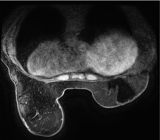 Figure 11b