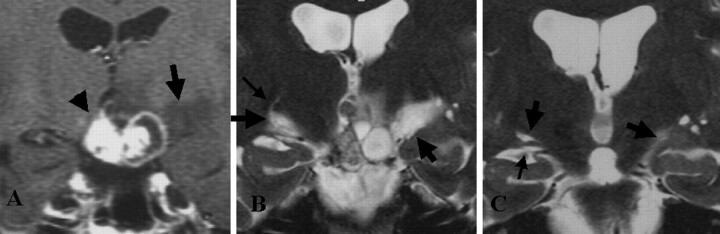 Fig 1.