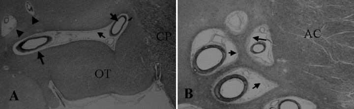 Fig 3.