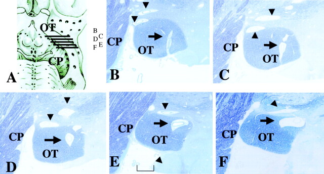 Fig 5.