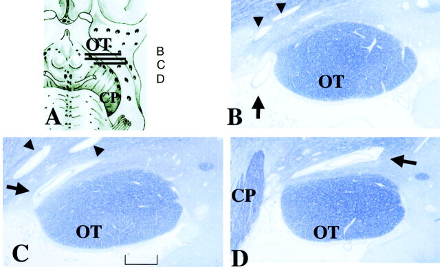 Fig 4.