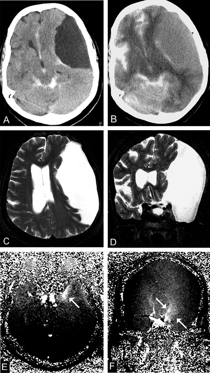 Fig 4.