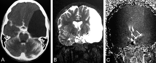 Fig 2.