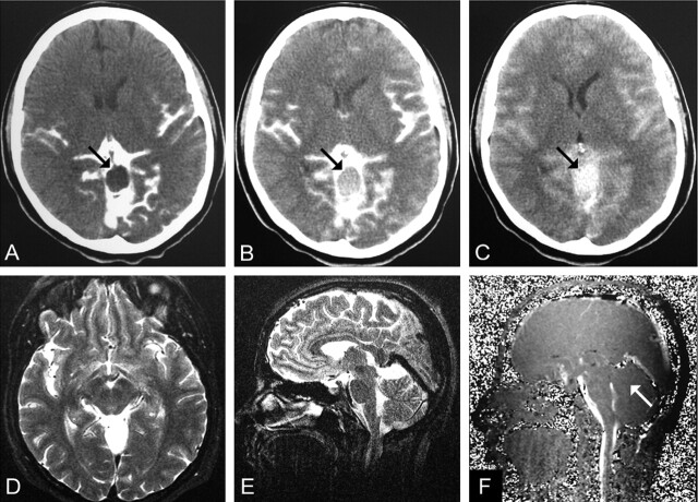 Fig 3.