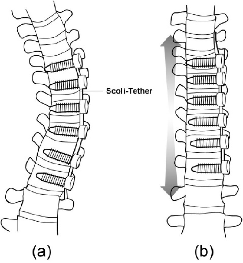 Fig. (4)