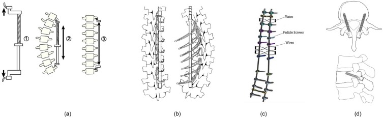 Fig. (3)