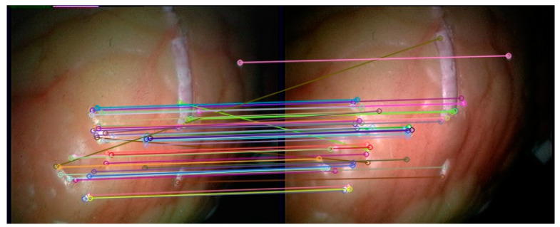 Figure 13