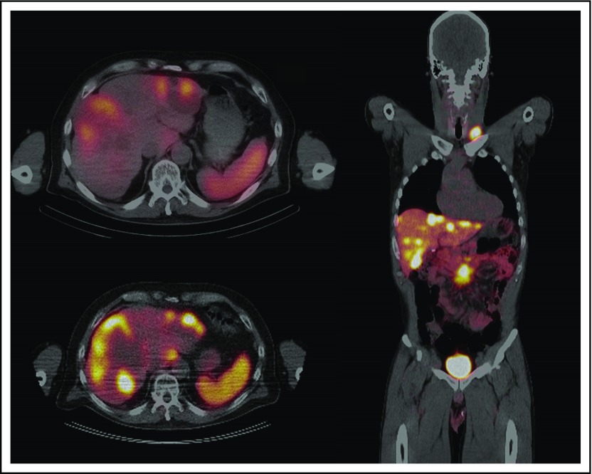 Fig 2.