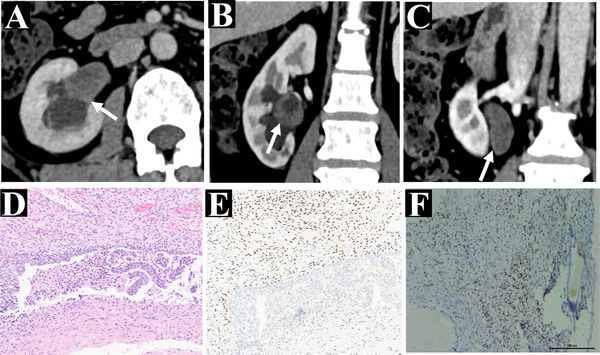 FIGURE 2