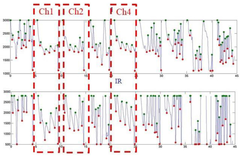 Figure 14