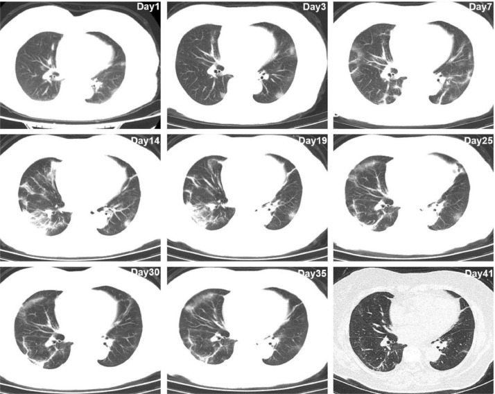 Fig 3