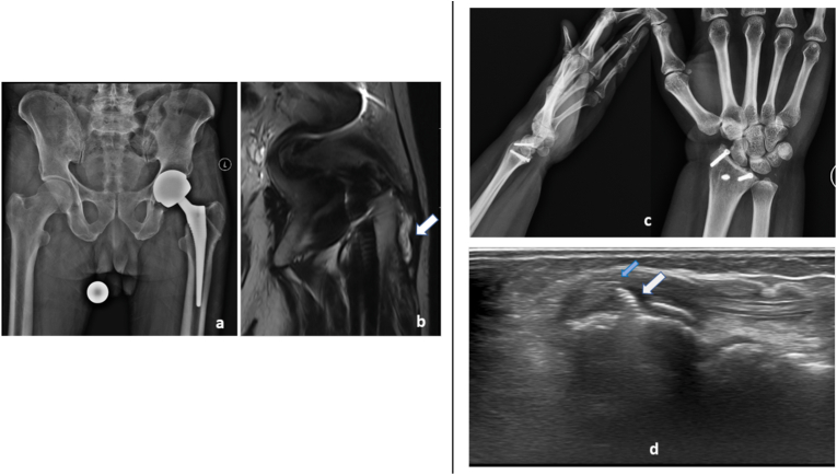 Fig. 8