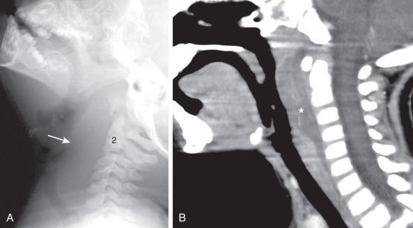 FIGURE 1.5