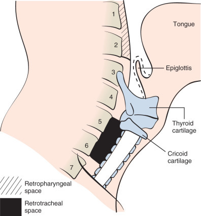 FIGURE 1.6