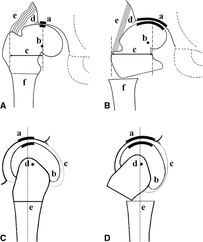 Fig. 1A–D