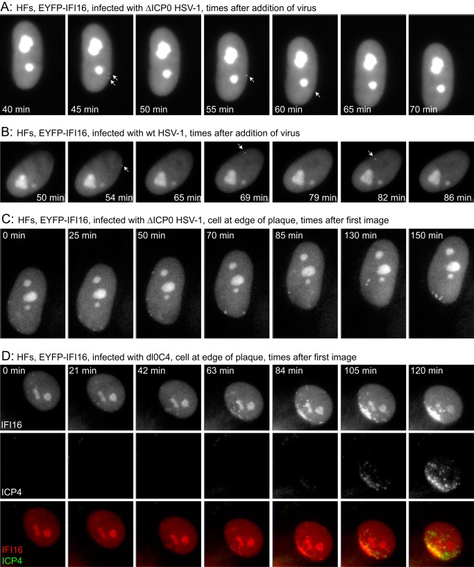 FIG 3