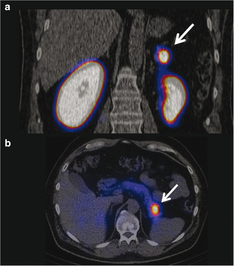 Fig. 6