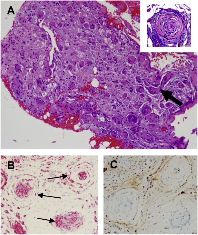 Fig. 3