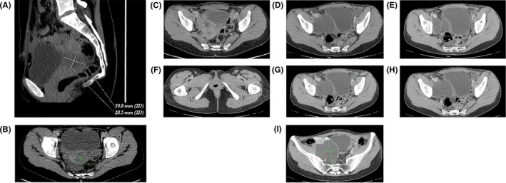 FIGURE 3