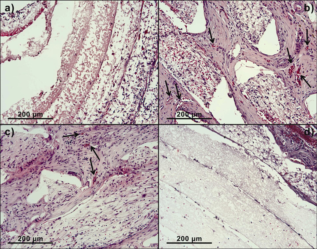 Figure VI