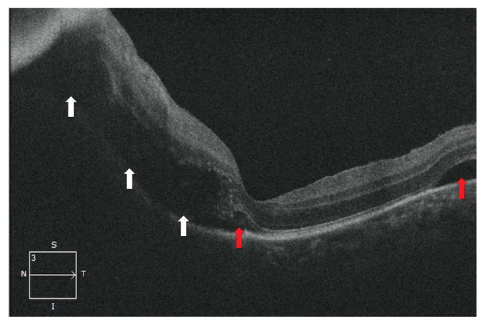 Figure 3: