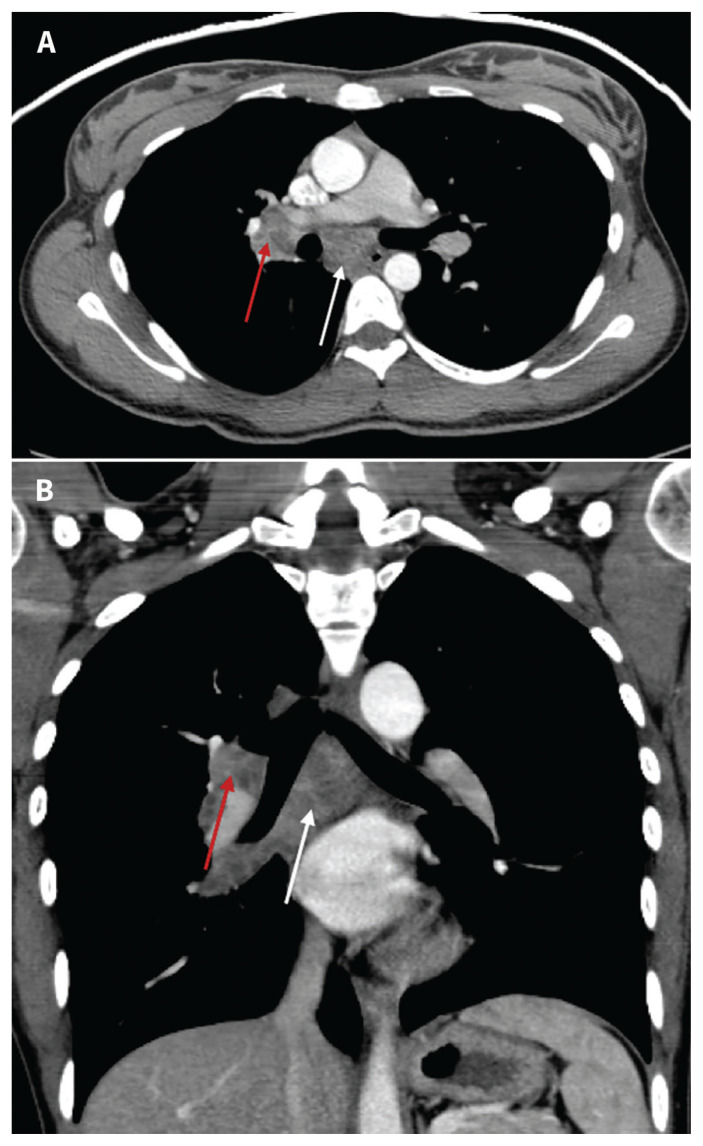 Figure 4:
