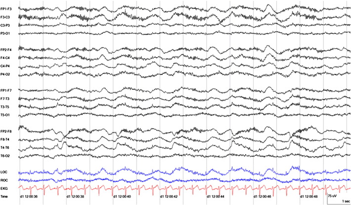 Fig. 2