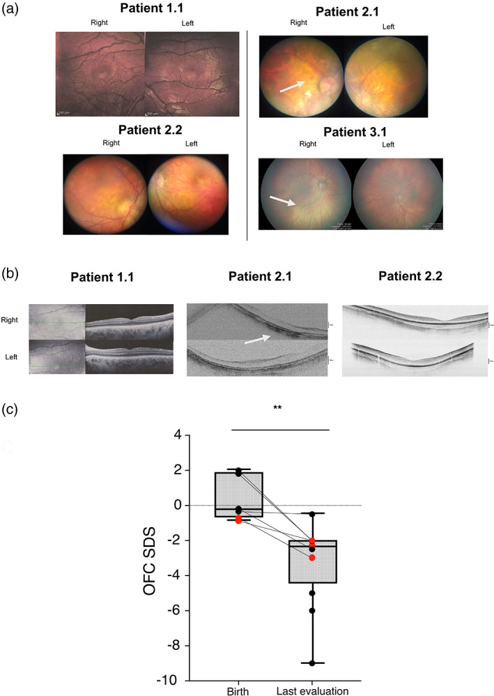 FIGURE 2