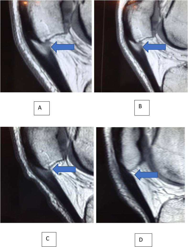 Fig. 9