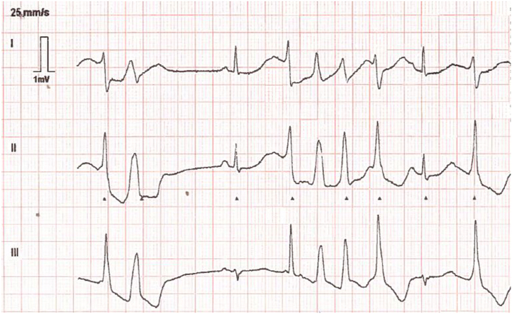 Figure 1