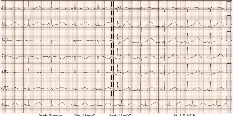 Figure 2