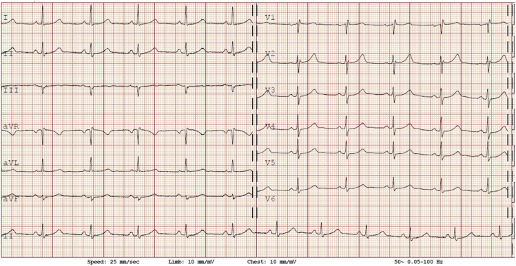 Figure 3