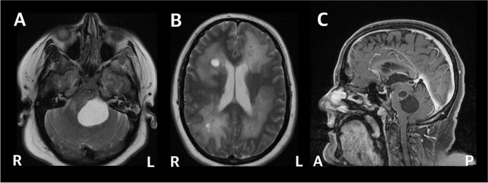 Fig. 1