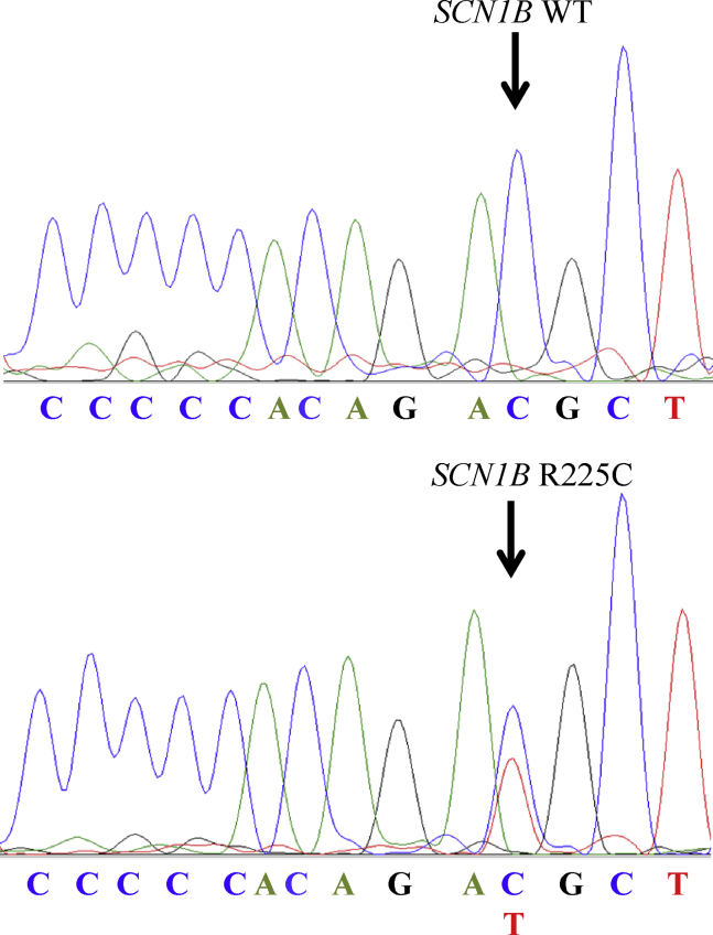 Figure 1