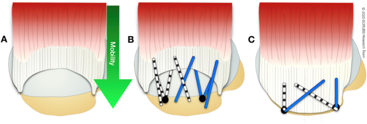 Fig. 3