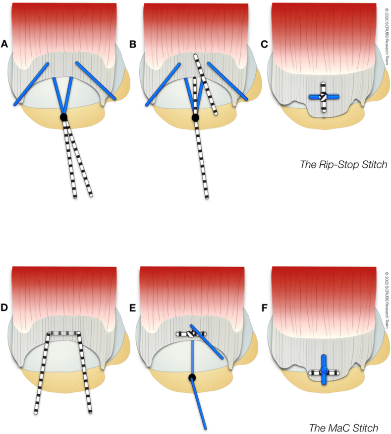 Fig. 2