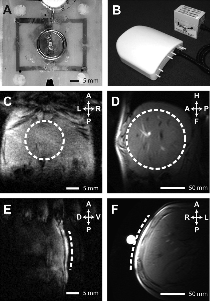 Fig 2