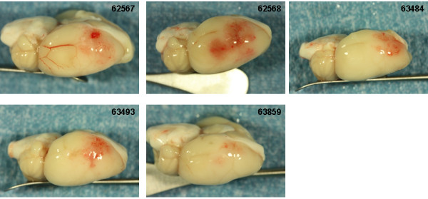 Figure 11