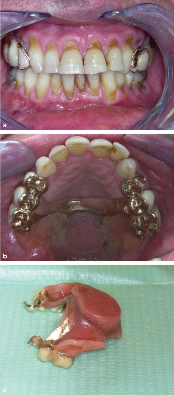 Figure 2 a, b, c