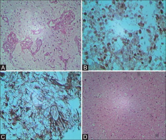 Figure 5 (A-D)