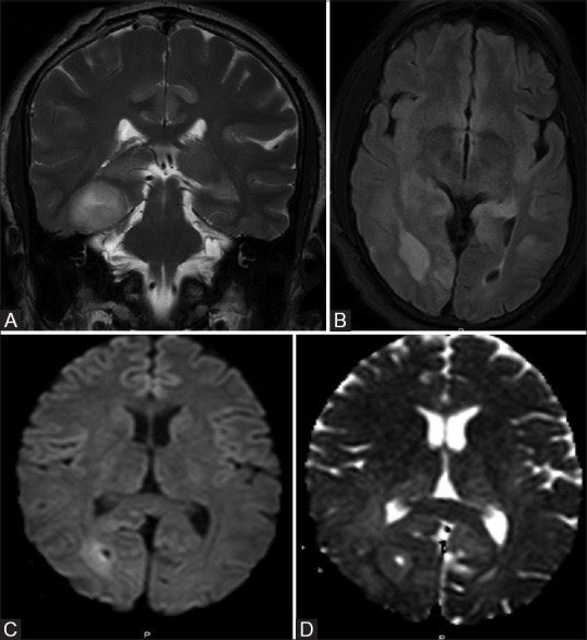 Figure 1 (A-D)