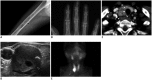 Fig. 12