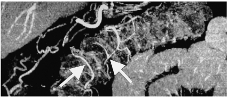 Fig. 18