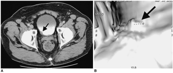 Fig. 14