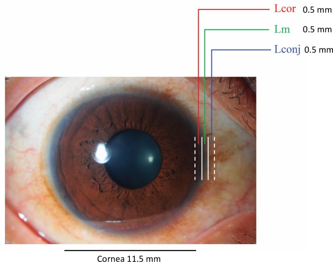 Fig 1