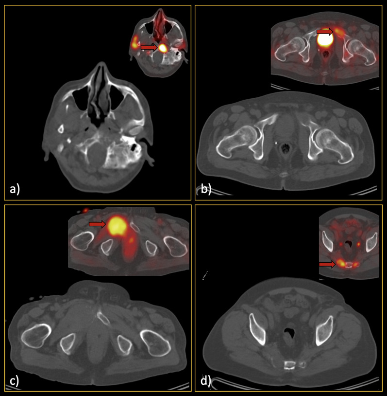 Fig. 6