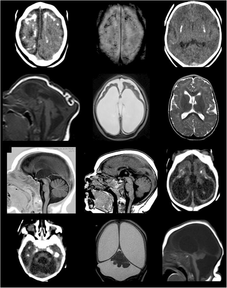 Fig. 1