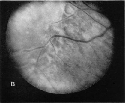 FIGURE 12 B