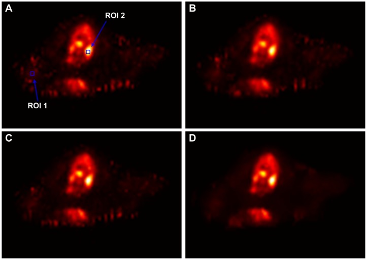 Figure 11